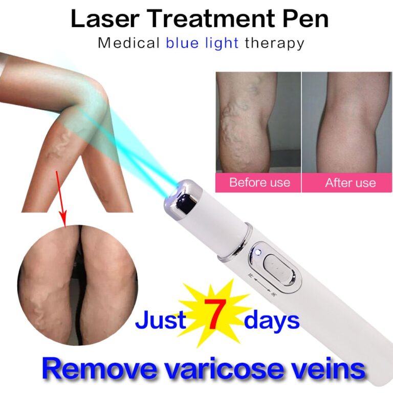 2pcs Acne Laser Pen Portable Varicose Veins Wrinkle Removal Machine